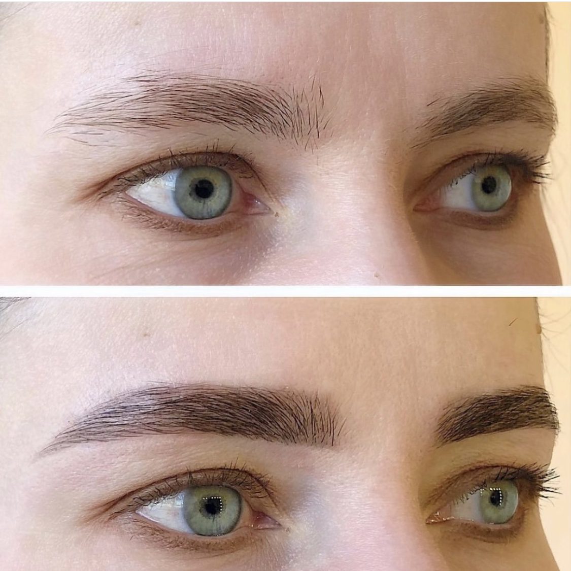 Sourcils Brow lift