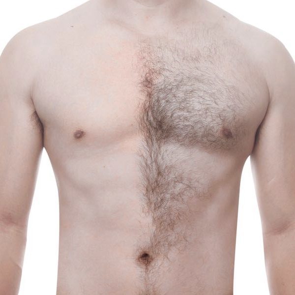 Men’s hair removal
